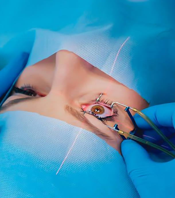 LASIK Treatment